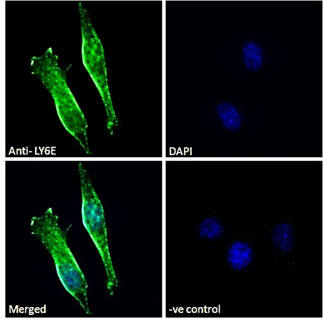 Ly-6E Antibody in Immunocytochemistry (ICC/IF)