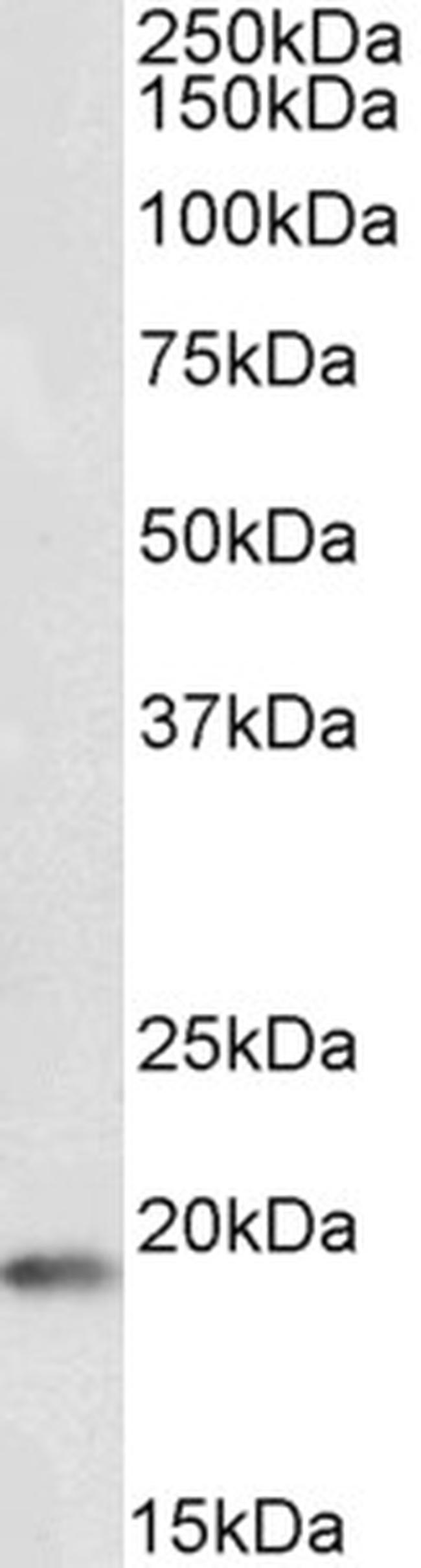 CIRBP Antibody in Western Blot (WB)