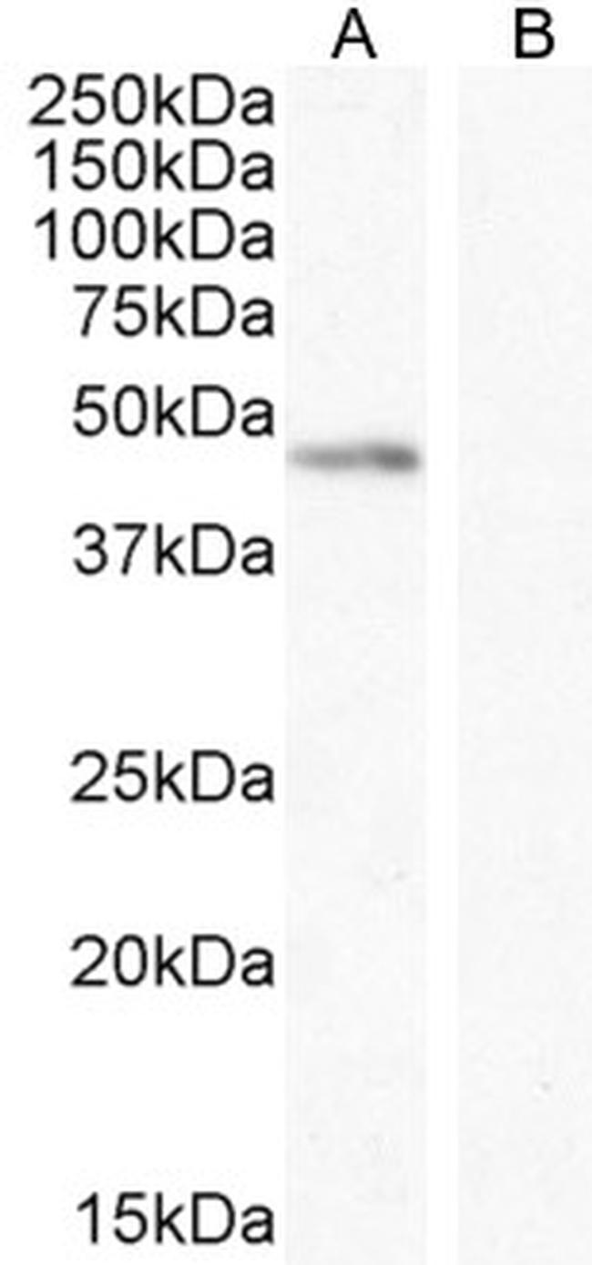 Angiopoietin 1 Antibody in Western Blot (WB)