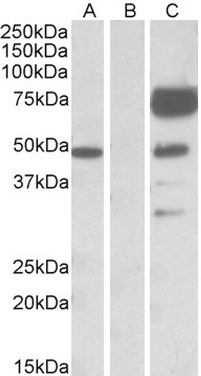 Angiopoietin 1 Antibody in Western Blot (WB)