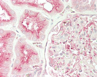 UNC13B Antibody in Immunohistochemistry (Paraffin) (IHC (P))