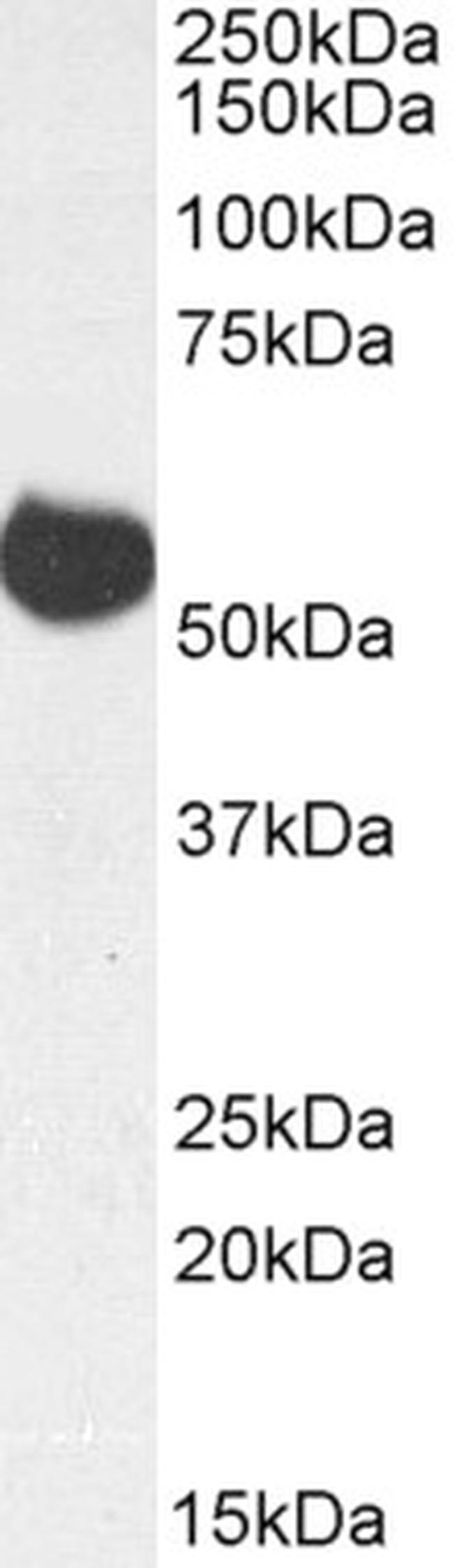 ALDH5A1 Antibody in Western Blot (WB)