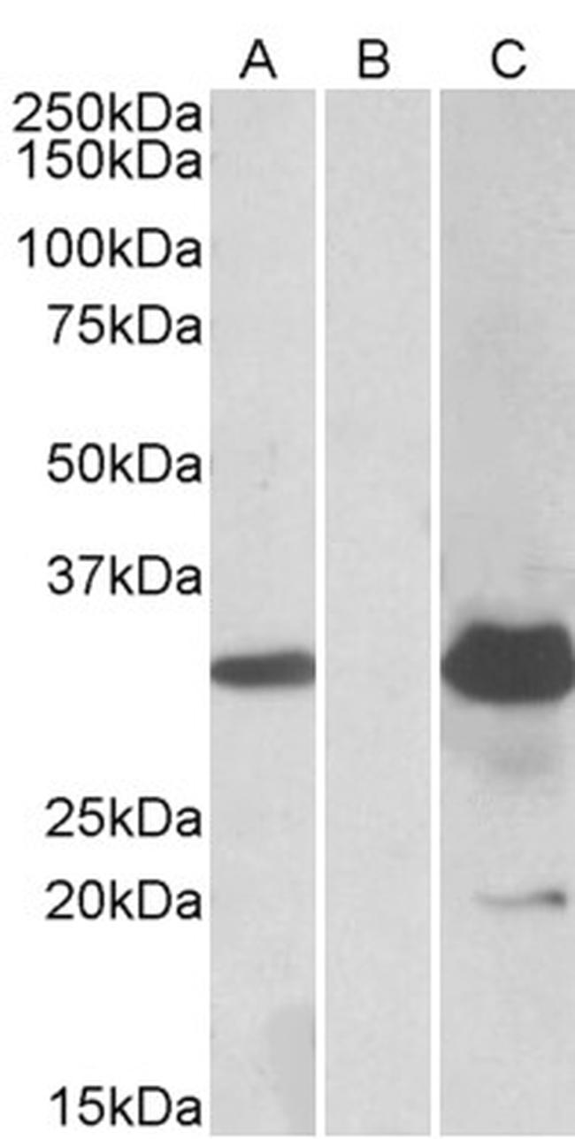 KCTD11 Antibody in Western Blot (WB)