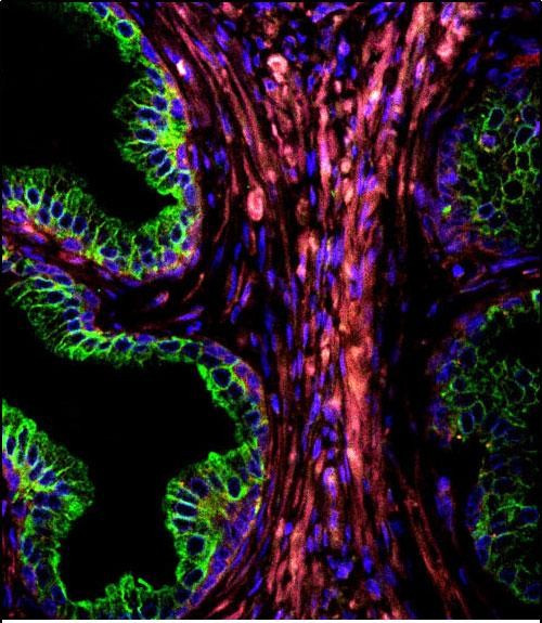 Cytokeratin 18 Antibody in Immunocytochemistry (ICC/IF)