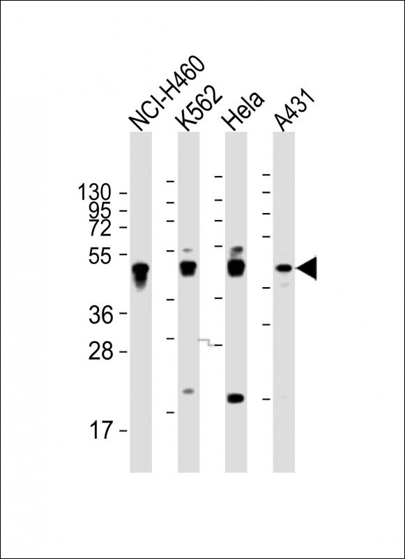 Cytokeratin 18 Antibody in Western Blot (WB)