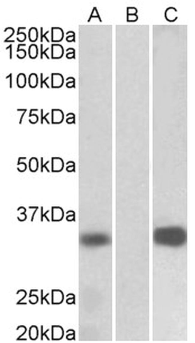 KChIP3 Antibody in Western Blot (WB)