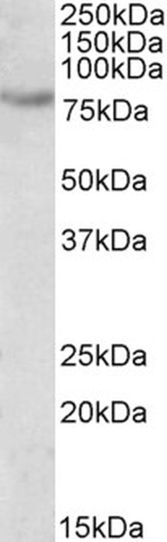 SIM2 Antibody in Western Blot (WB)