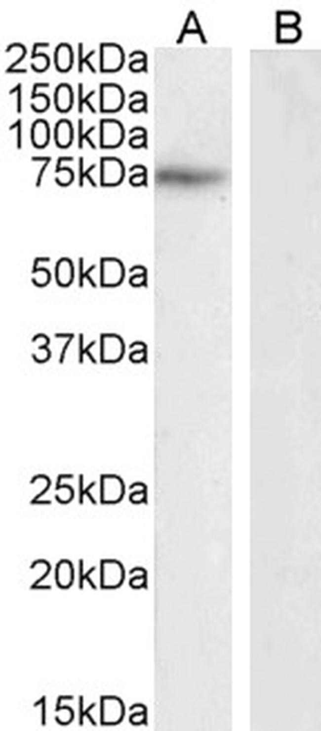 NOX2 Antibody in Western Blot (WB)