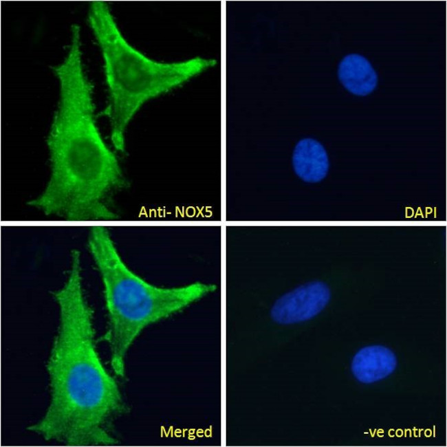 NOX5 Antibody in Immunocytochemistry (ICC/IF)