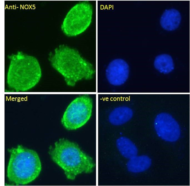 NOX5 Antibody in Immunocytochemistry (ICC/IF)