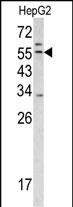 TMPRSS2 Antibody in Western Blot (WB)