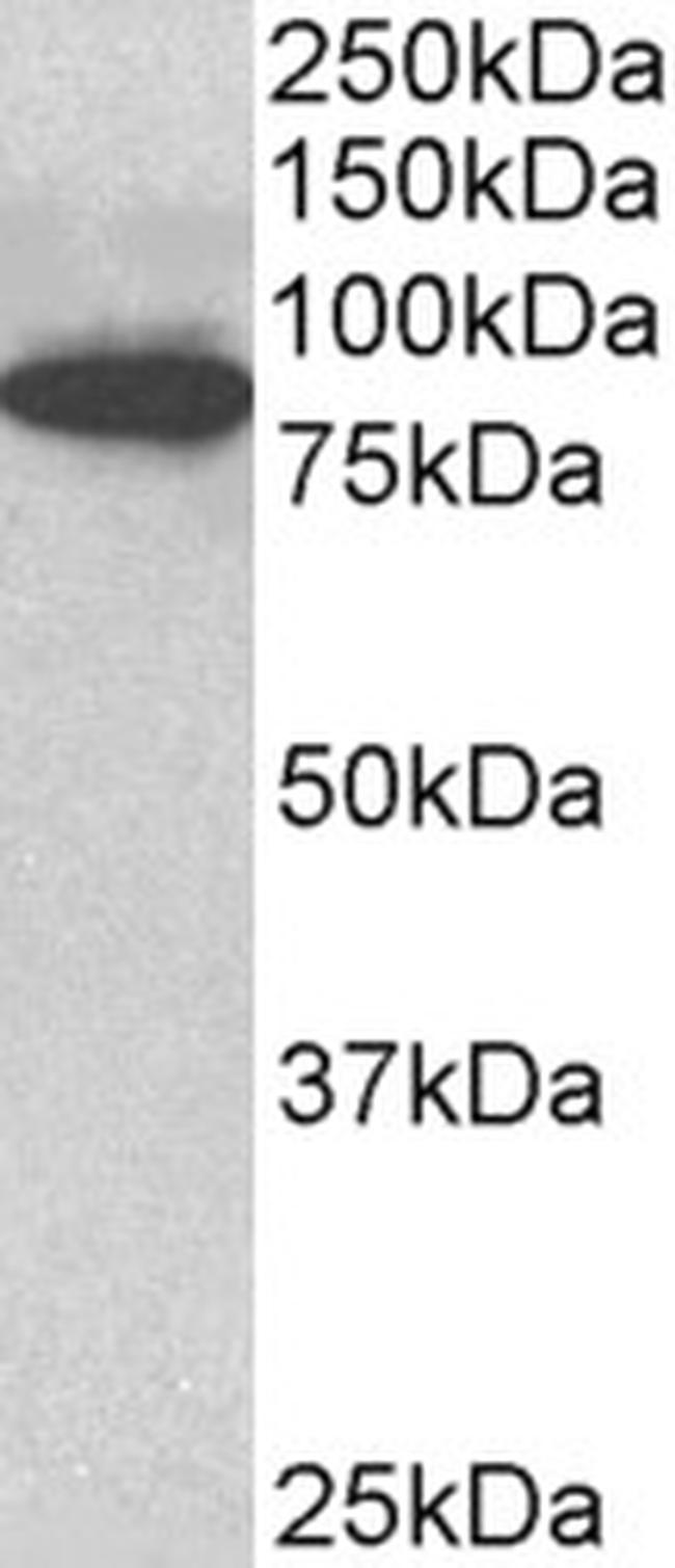 ODF2 Antibody in Western Blot (WB)