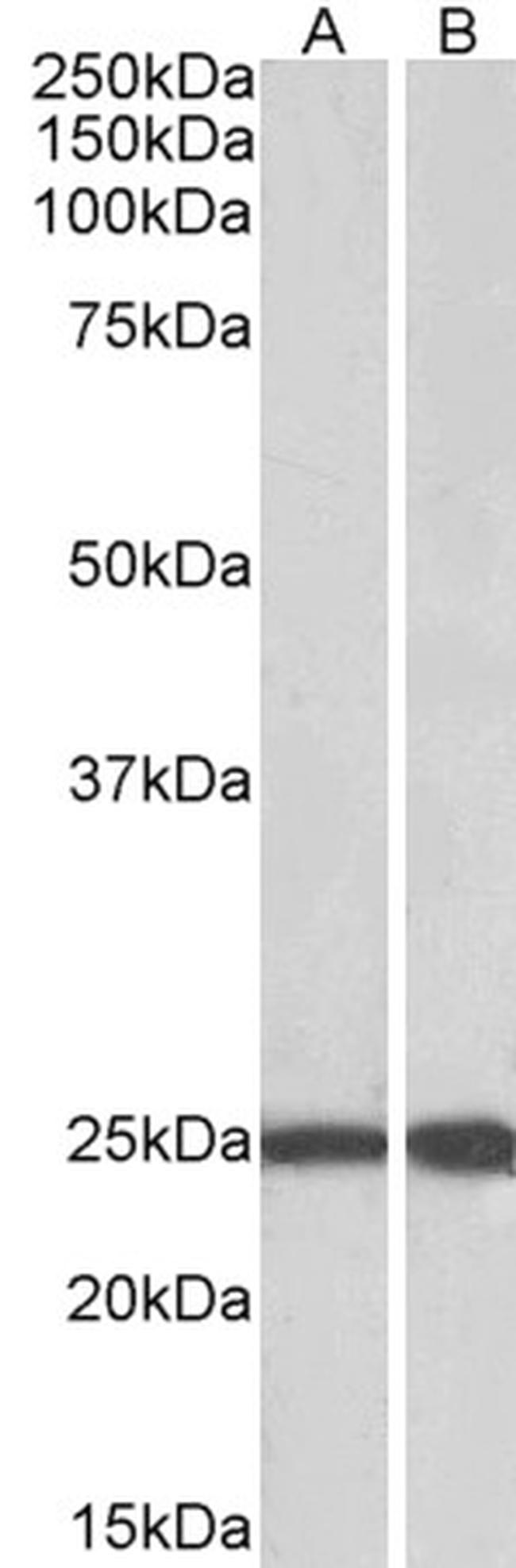 RAN Antibody in Western Blot (WB)