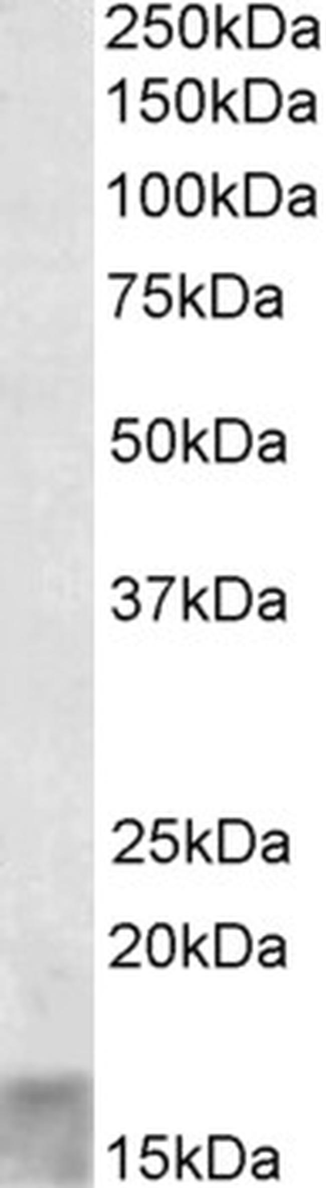 SCOC Antibody in Western Blot (WB)