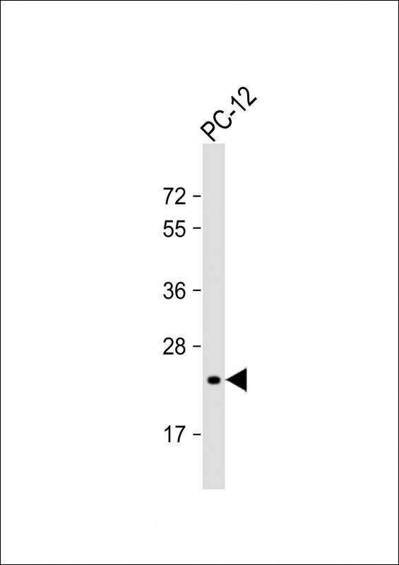 DHFR Antibody in Western Blot (WB)