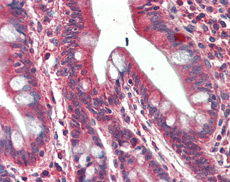 SH3GL1 Antibody in Immunohistochemistry (Paraffin) (IHC (P))