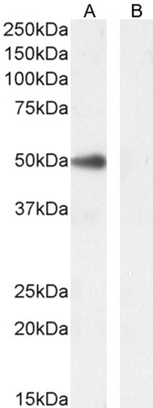 PAX1 Antibody in Western Blot (WB)