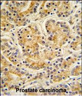 MOB1 Antibody in Immunohistochemistry (Paraffin) (IHC (P))