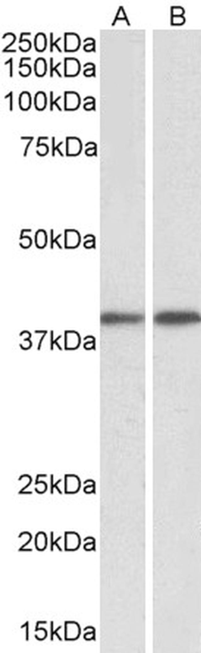 GNAQ Antibody in Western Blot (WB)