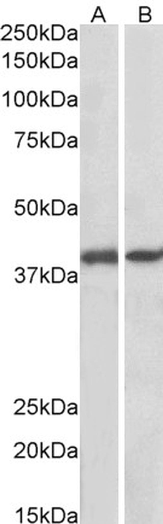 GNAQ Antibody in Western Blot (WB)