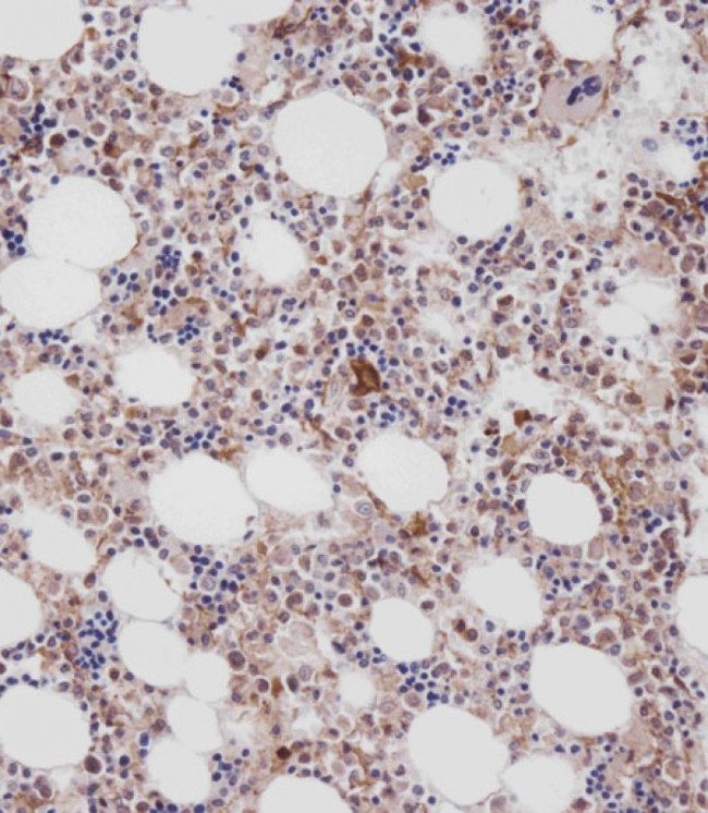 Cathepsin K Antibody in Immunohistochemistry (Paraffin) (IHC (P))