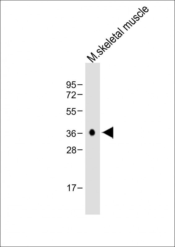 Cathepsin K Antibody in Western Blot (WB)