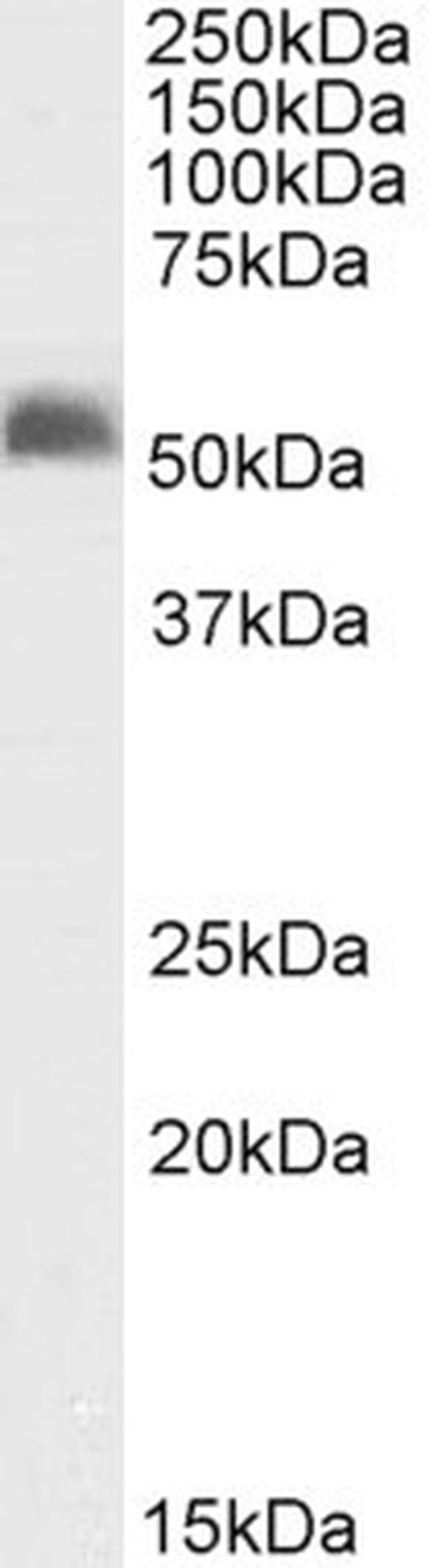 GABRG2 Antibody in Western Blot (WB)