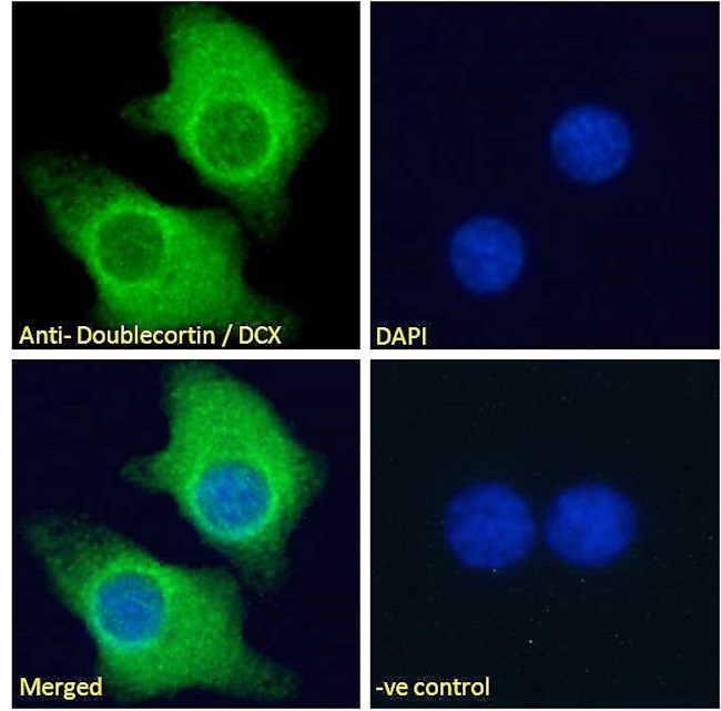 Doublecortin Antibody in Immunocytochemistry (ICC/IF)