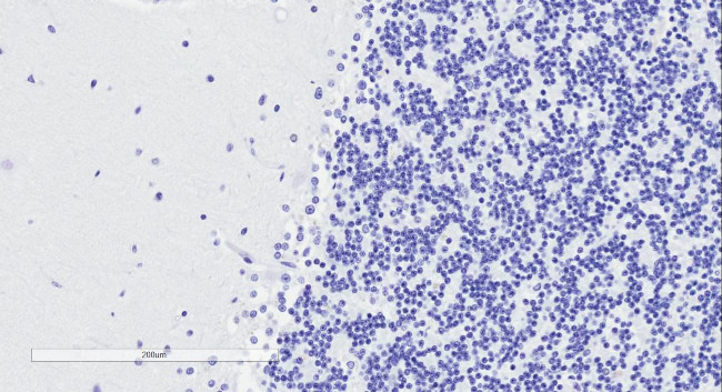 Doublecortin Antibody in Immunohistochemistry (Paraffin) (IHC (P))