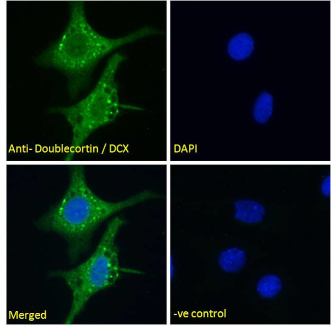 Doublecortin Antibody in Immunocytochemistry (ICC/IF)