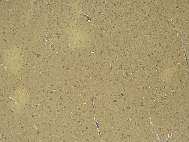 Doublecortin Antibody in Immunohistochemistry (Paraffin) (IHC (P))