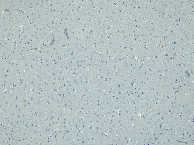 Doublecortin Antibody in Immunohistochemistry (Paraffin) (IHC (P))