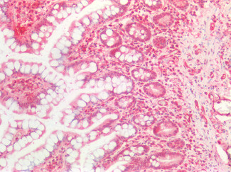 NOTCH1 Antibody in Immunohistochemistry (Paraffin) (IHC (P))