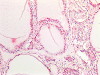 NOTCH1 Antibody in Immunohistochemistry (Paraffin) (IHC (P))