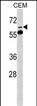 FKBP10 Antibody in Western Blot (WB)