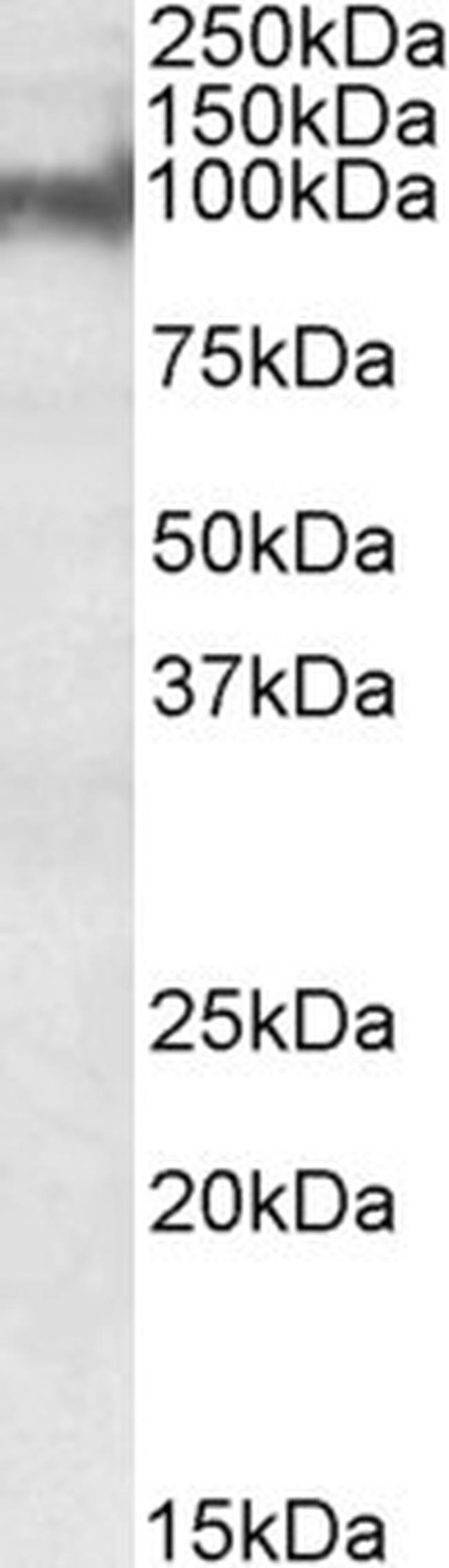 PKP2 Antibody in Western Blot (WB)