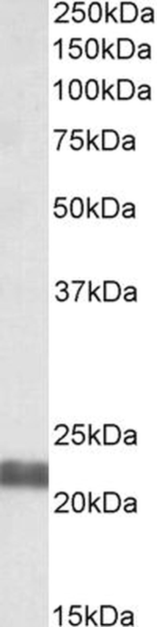 NCE2 Antibody in Western Blot (WB)