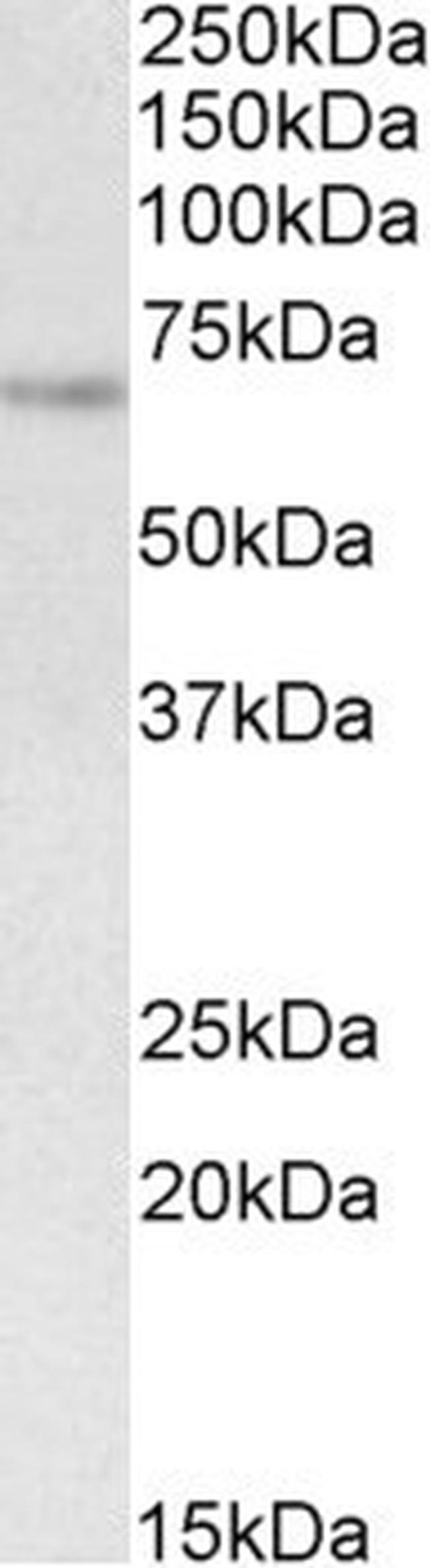 UBASH3A Antibody in Western Blot (WB)