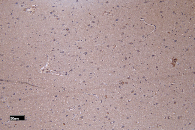 PTCH Antibody in Immunohistochemistry (Paraffin) (IHC (P))