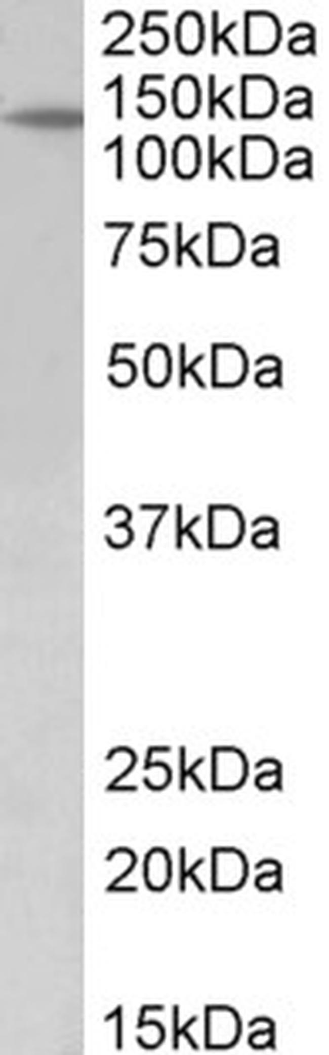 PTCH Antibody in Western Blot (WB)