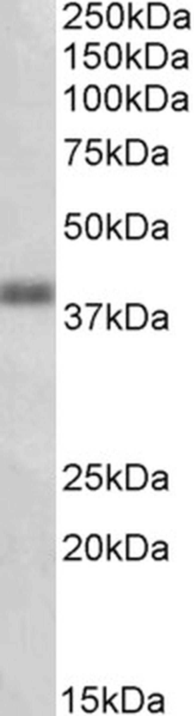 OXER1 Antibody in Western Blot (WB)