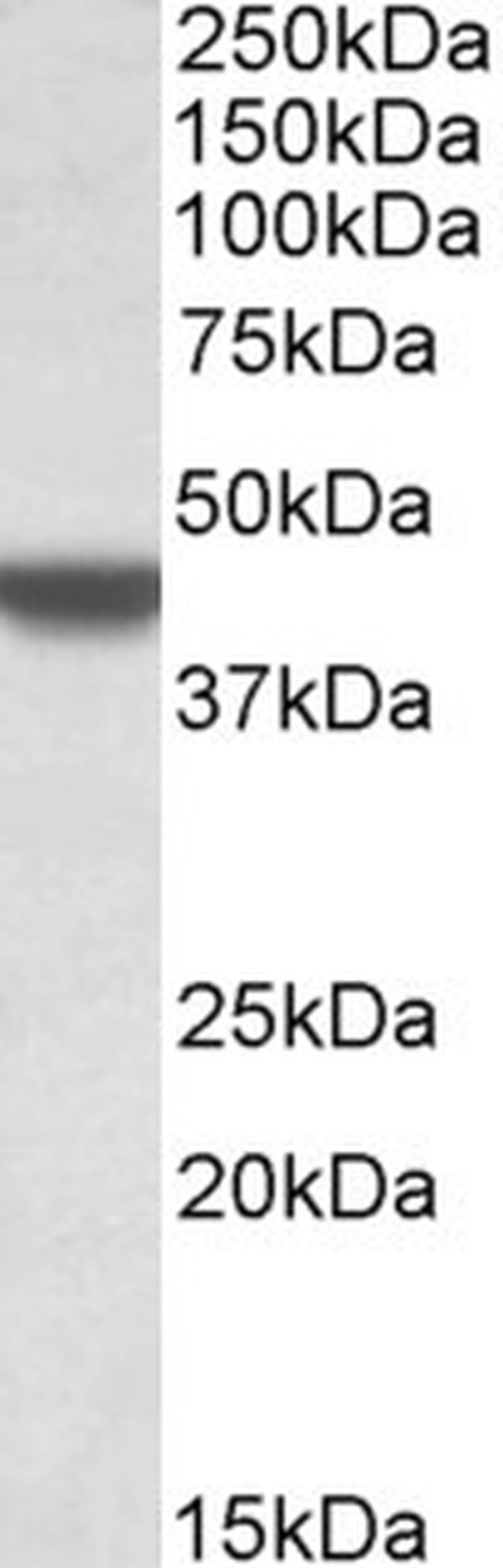 APOBEC3D Antibody in Western Blot (WB)