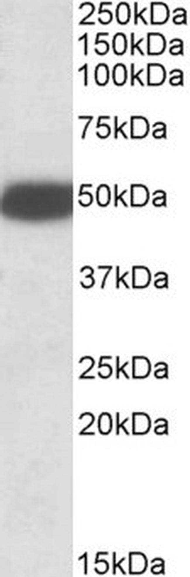 HTR3B Antibody in Western Blot (WB)