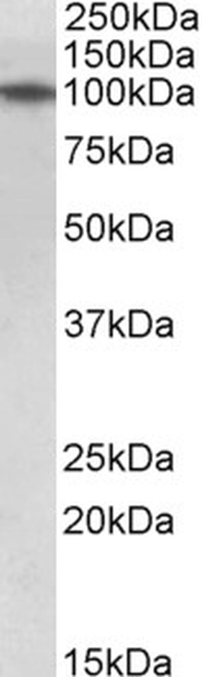 TXNDC11 Antibody in Western Blot (WB)