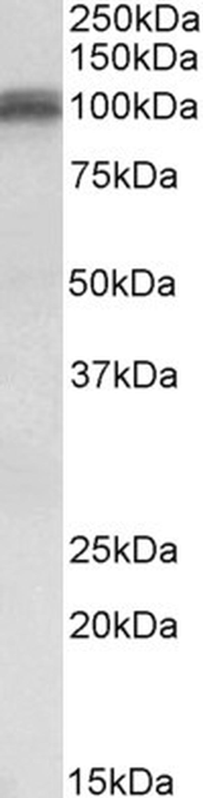 GluR1 Antibody in Western Blot (WB)