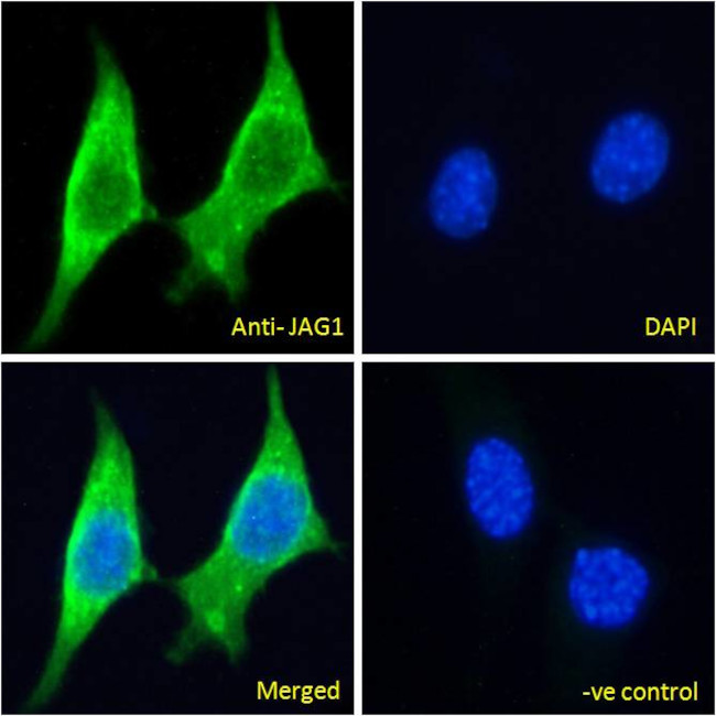 Jagged1 Antibody in Immunocytochemistry (ICC/IF)