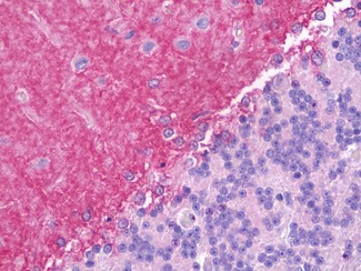 Jagged1 Antibody in Immunohistochemistry (Paraffin) (IHC (P))