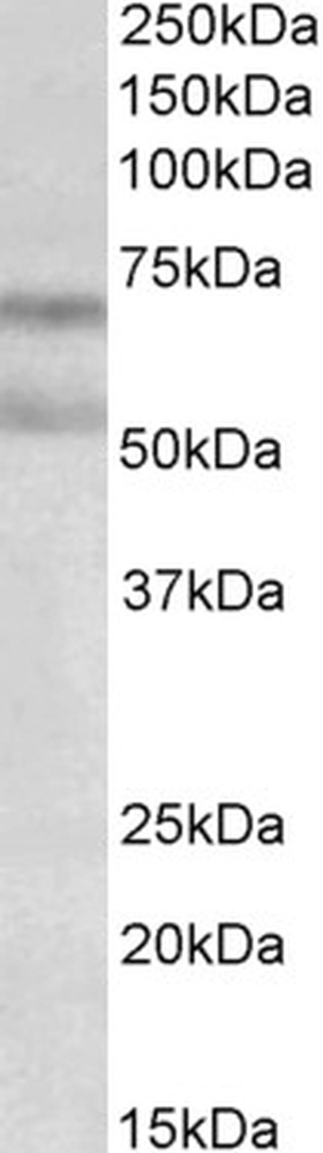 Cannabinoid Receptor 1 Antibody in Western Blot (WB)