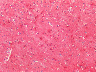 SOD2 (MnSOD) Antibody in Immunohistochemistry (Paraffin) (IHC (P))