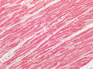 SOD2 (MnSOD) Antibody in Immunohistochemistry (Paraffin) (IHC (P))